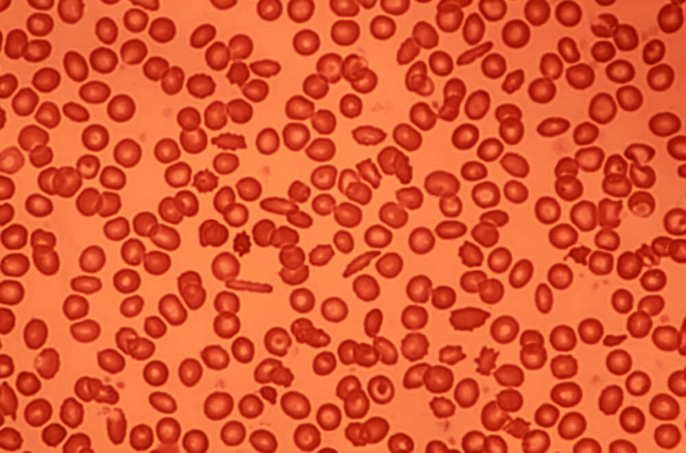 redbloodcells (1)